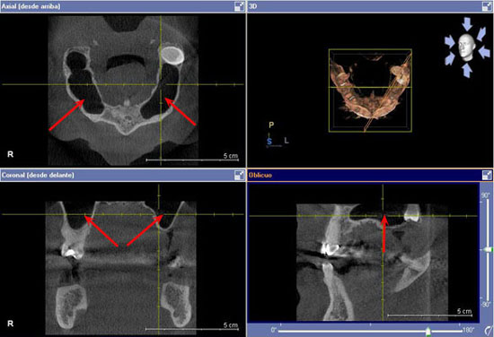 medios-tecnicos-dentales-escaner-2