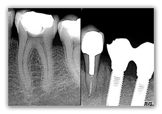 radiografia-dental_2