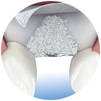 tratamientos de encias especialistas periodontales en madrid